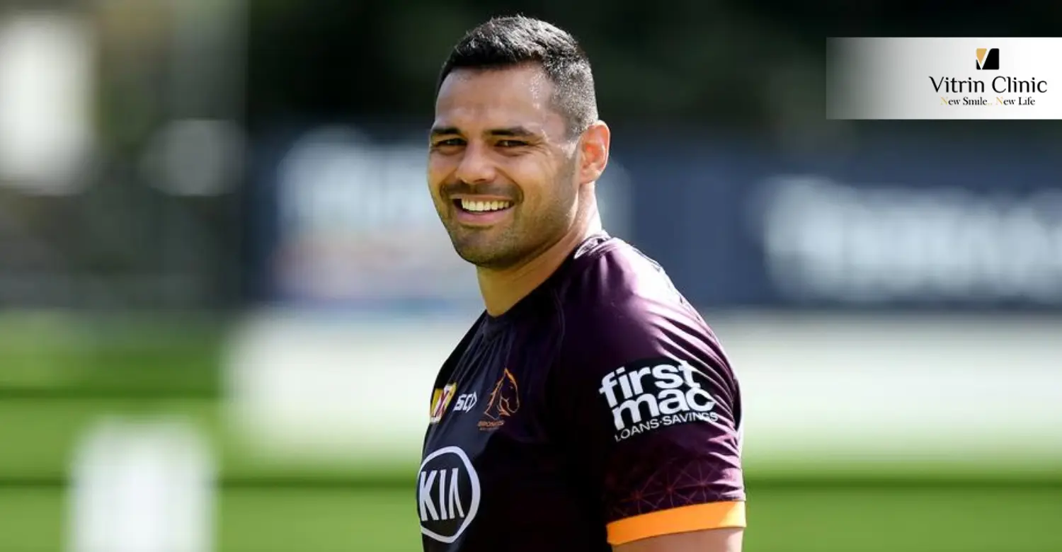 ¿Por qué a los fans les encanta la sonrisa de Ben Teo?